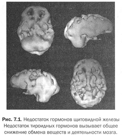 Измени Мозг Изменится И Жизнь